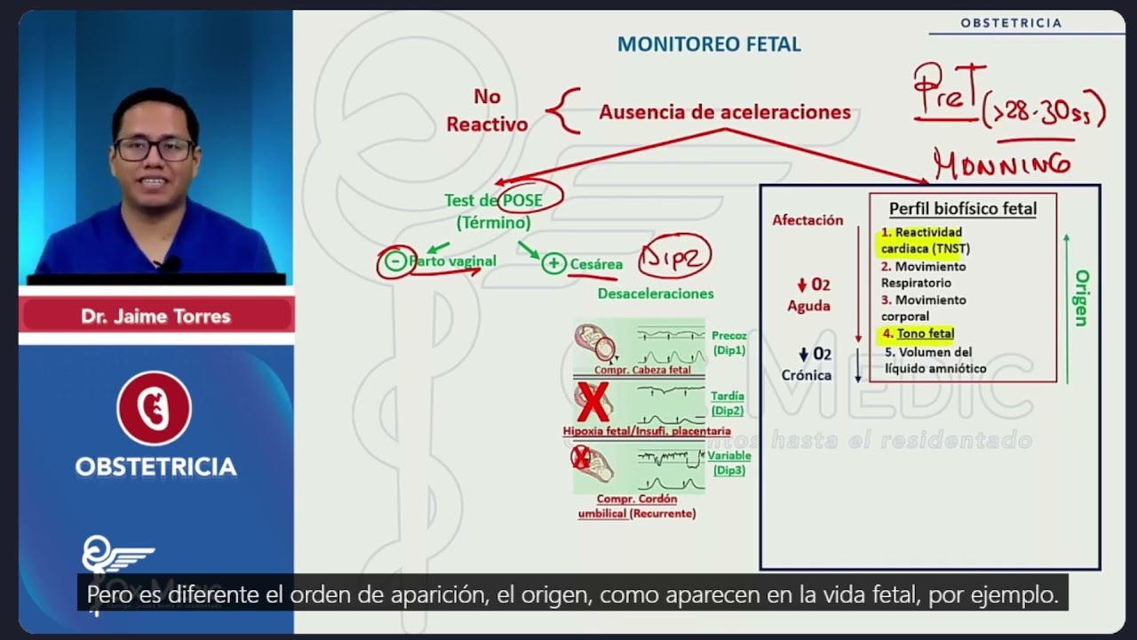 MONITOREO FETAL