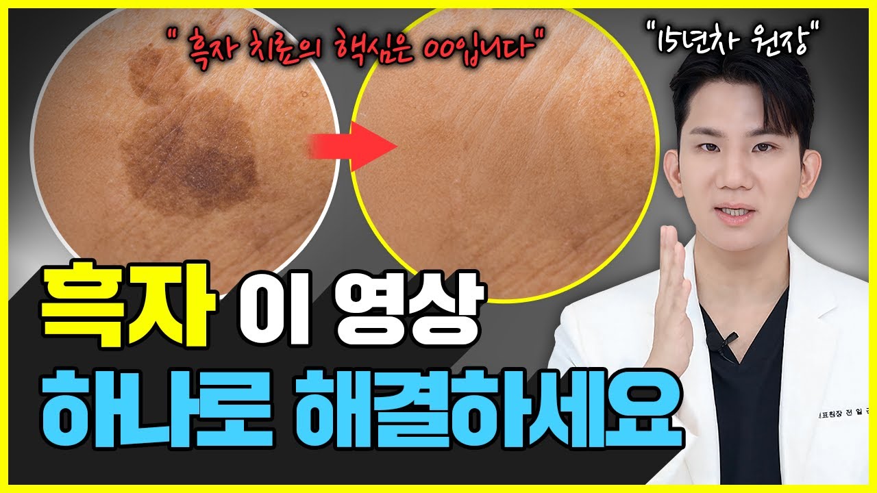 “흑자로 피부과 오지마세요” 단돈 '만원'으로 흑자 집에서 쉽게 없애는 방법과 기미 검버섯 구분하는 법! | 피부흑자, 기미없애는법, 검버섯없애는방법