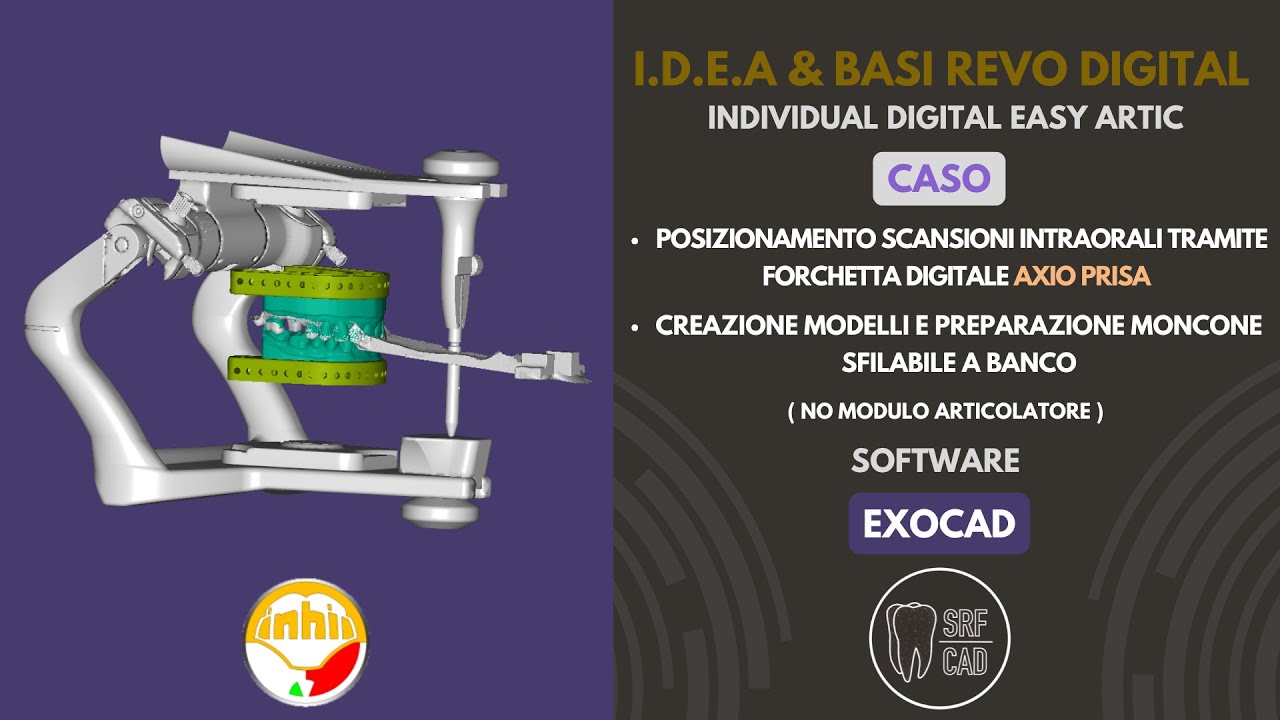 EXOCAD MODEL CRETOR AXIO PRISA IDEA REVO DIGITAL ARCO FACCIALE E MONCONE SFILABILE A BANCO ARTEX SAM