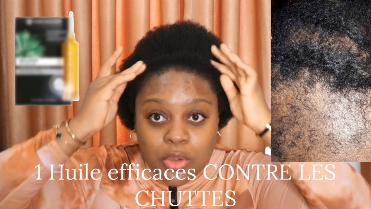 1 huile efficace contre les chutes . Comment guérir des chutes et avoir de long cheveux Afro