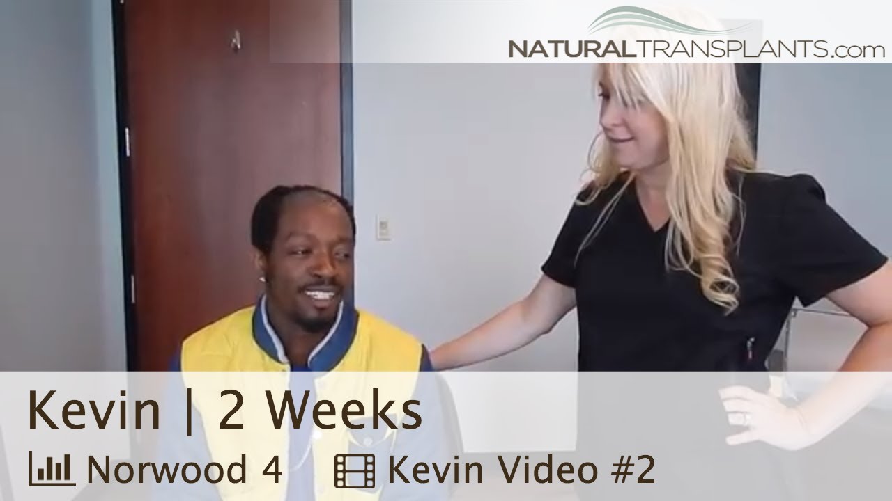African American Hair Loss Treatment Update | African American Hair Loss Doctors (Kevin)