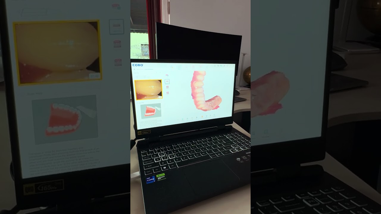🎥 Cat de bine si fluent functioneaza scannerul intraoral DL-300P COXO