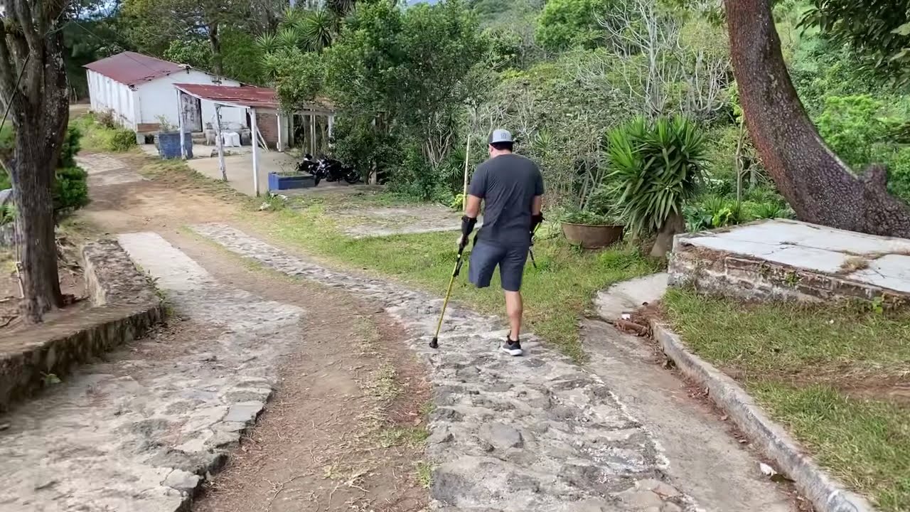 AMPUTEE LEG WALKING WITH CRUTCHES | AMPUTADO DE PIERNA CANINANDO CON MULETAS 👣🦵🏻