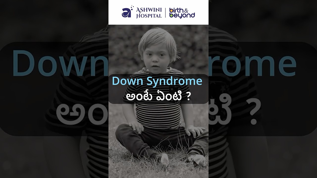 Down Syndrome: Causes & Early Diagnosis | How to Detect It in Pregnancy? #downsyndrome
