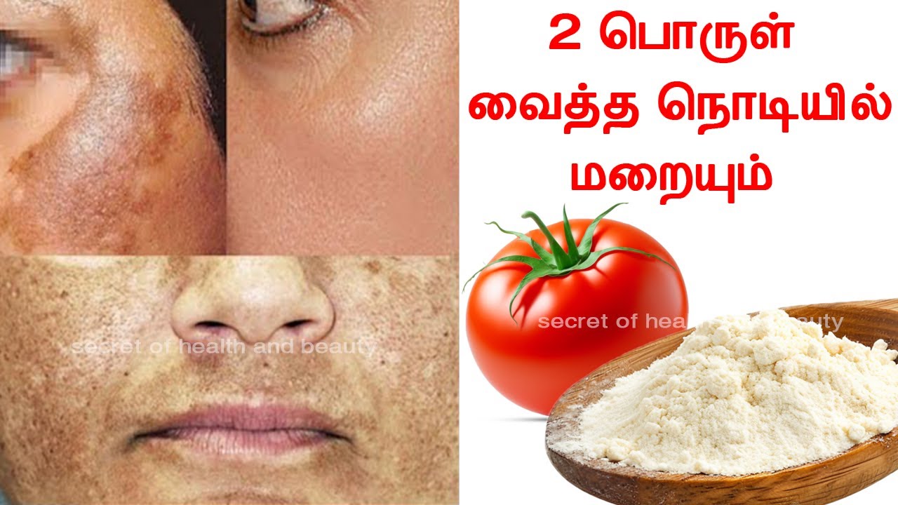 கண்ணிமைக்கும் நொடியில் மங்கு மாயமாய் மறைய இத தடவுங்க | Mangu maraya tips in tamil | pigmentation
