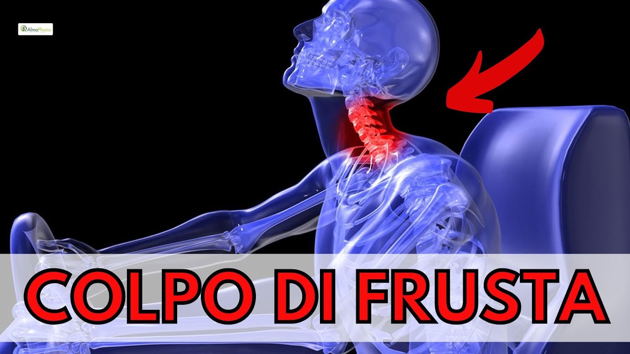 Cause ed ESERCIZI per RIVOLVERE il COLPO DI FRUSTA CERVICALE