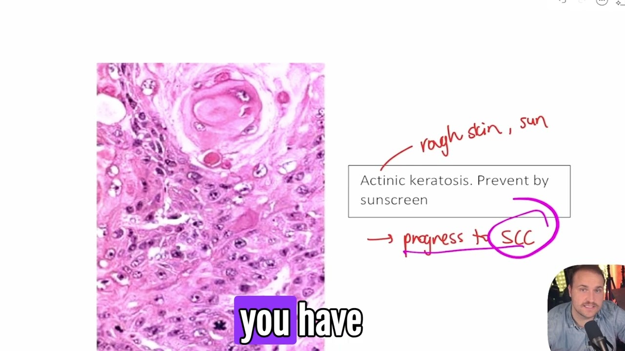 Explaining High Yield Medical Images Review for USMLE Step 1