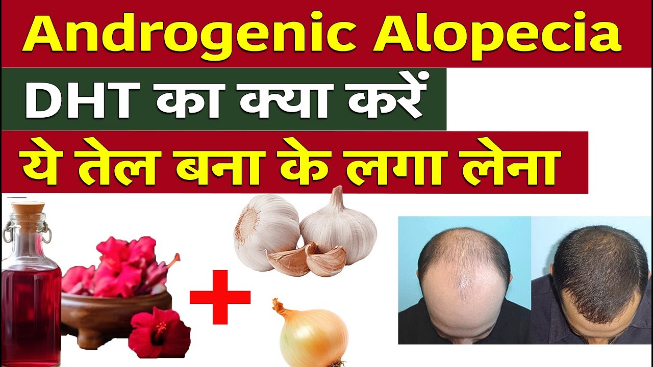 ये तेल बना कर सर पर लगा लो, बाल नहीं गिरेंगे Dr Prateek chauhan