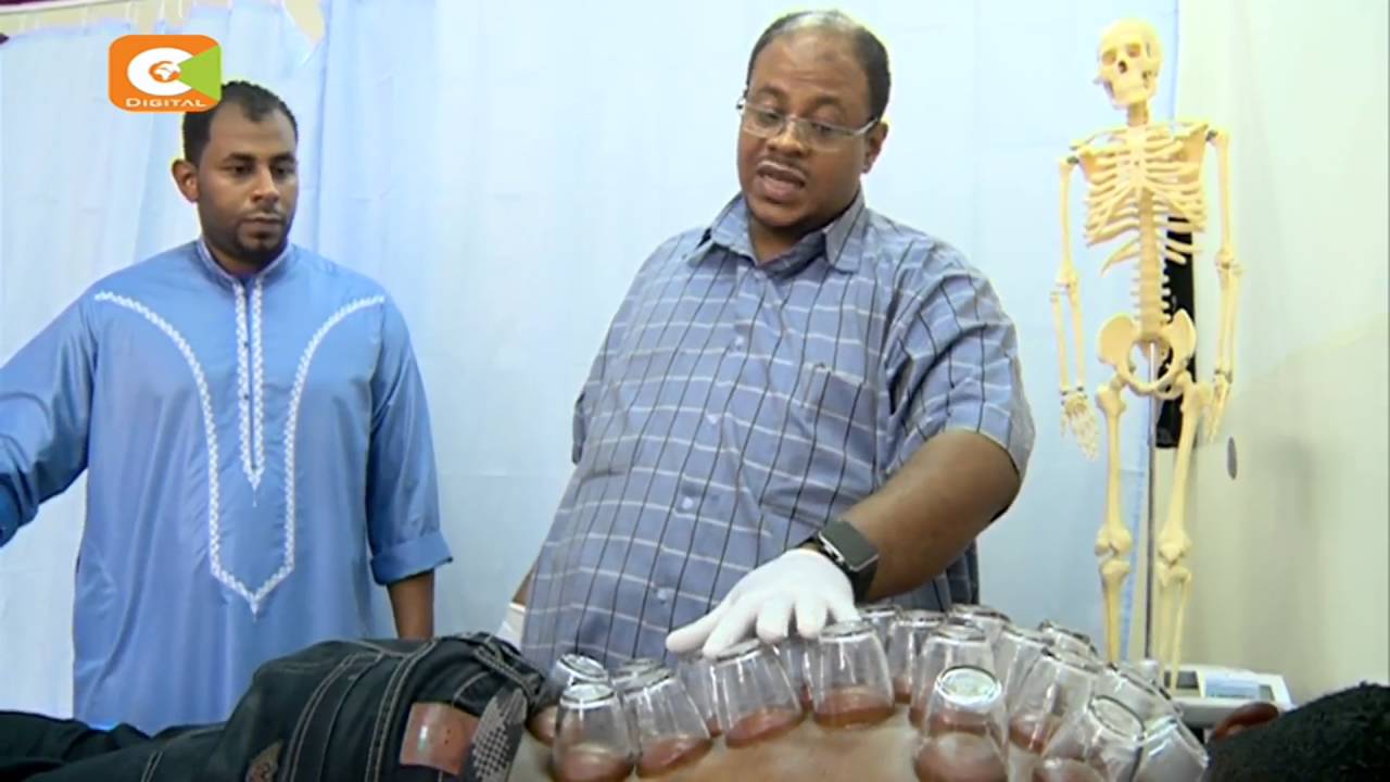 Dry cupping massage treatment taking root in Kenya
