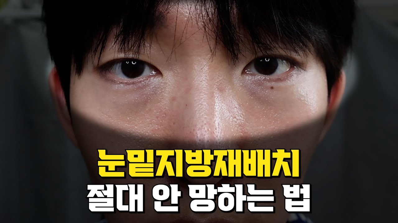 #눈밑지방재배치 수술을 받았습니다.