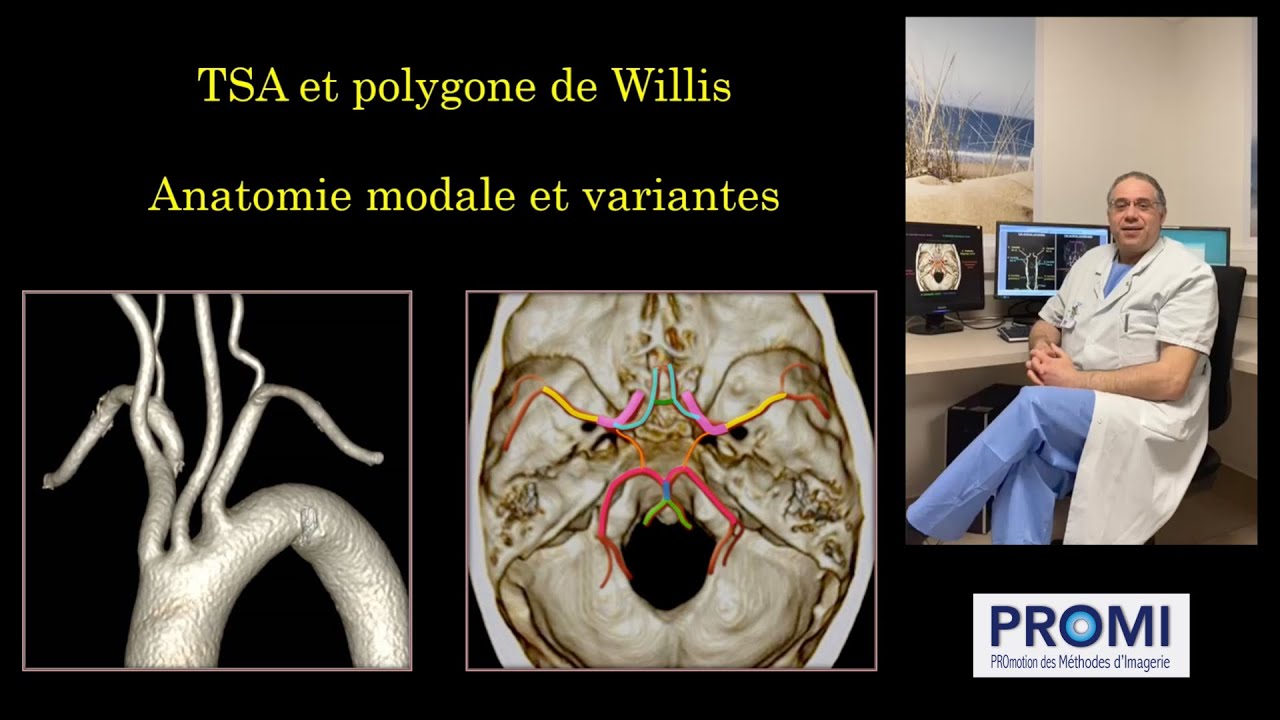 TSA et Polygone de Willis
