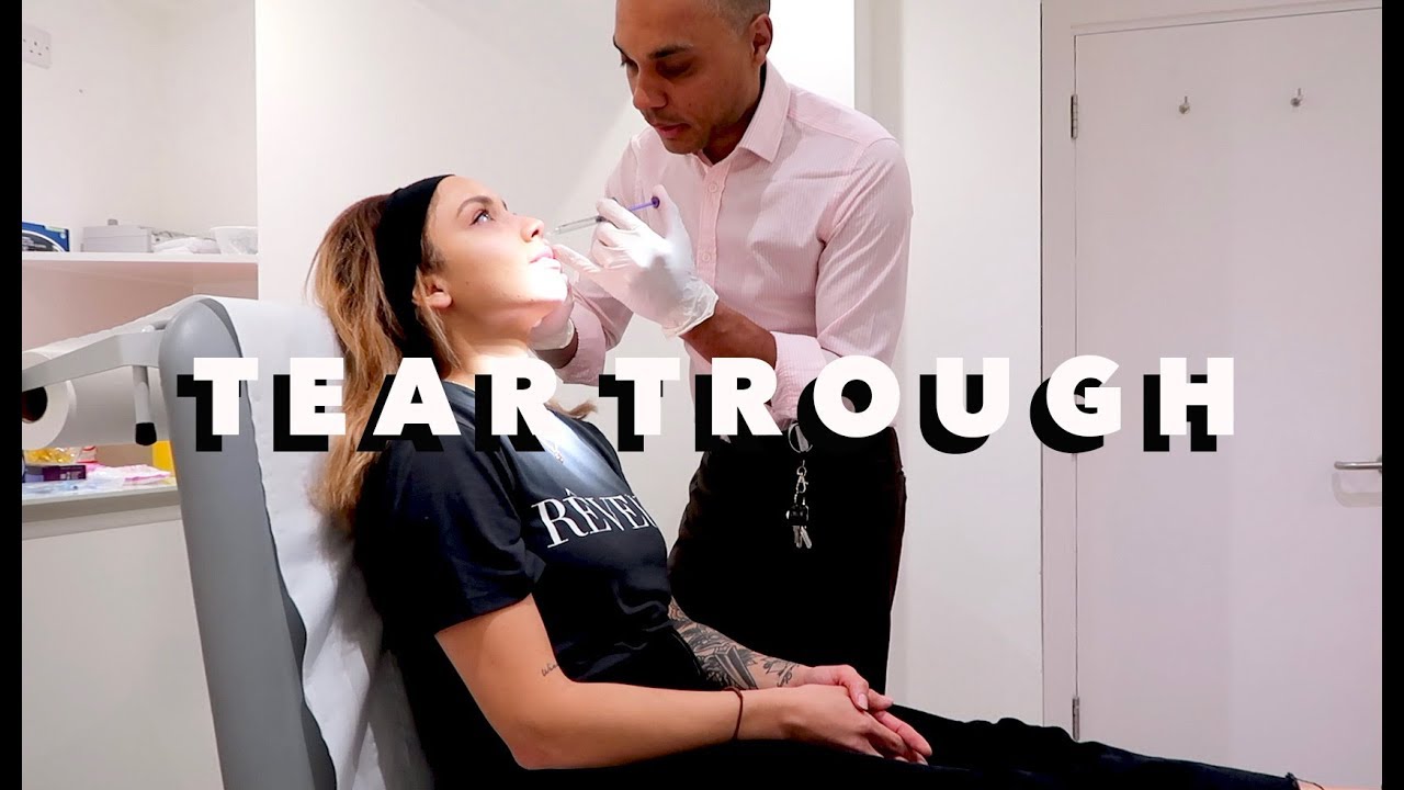 GETTING TEAR TROUGH FILLER + BATTLING A VIRUS!