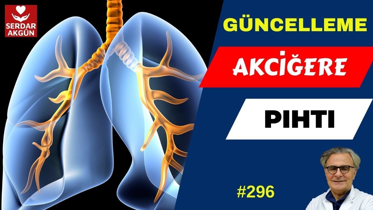 296. Damarda Pıhtı, Akciğere Pıhtı Atması, Serdar Akgün, Sağlıklı Yaşam