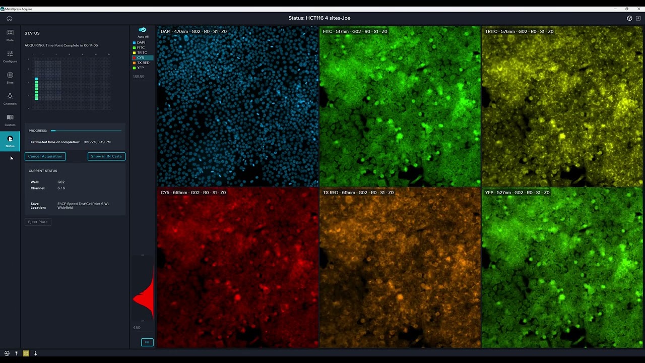 Cell Painting Acquisition in MetaXpress