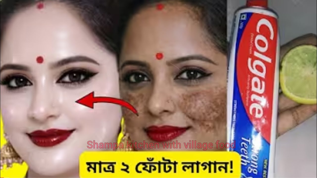 মাত্র দু ফোটা লাগাও মুখ আয়নার মতো জ্বলজ্বল করতে শুরু করবে পুরনো দাগ কালো দাগ সব পরিষ্কার হবে/Skin