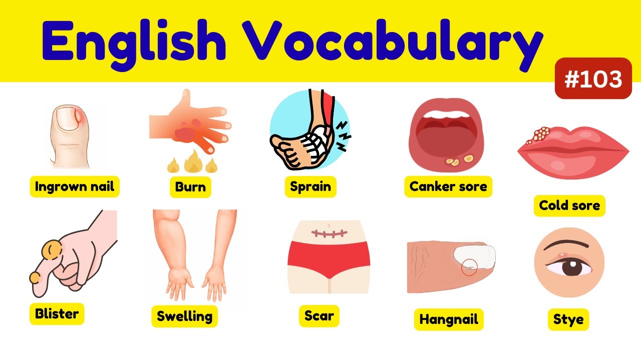 Stop Saying ‘It Hurts’ — Use These English Words