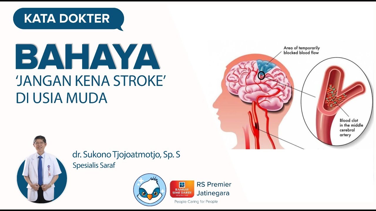 Jangan Lewatkan, Ini Dia Cara untuk Mencegah Stroke yang Harus Anda Ketahui