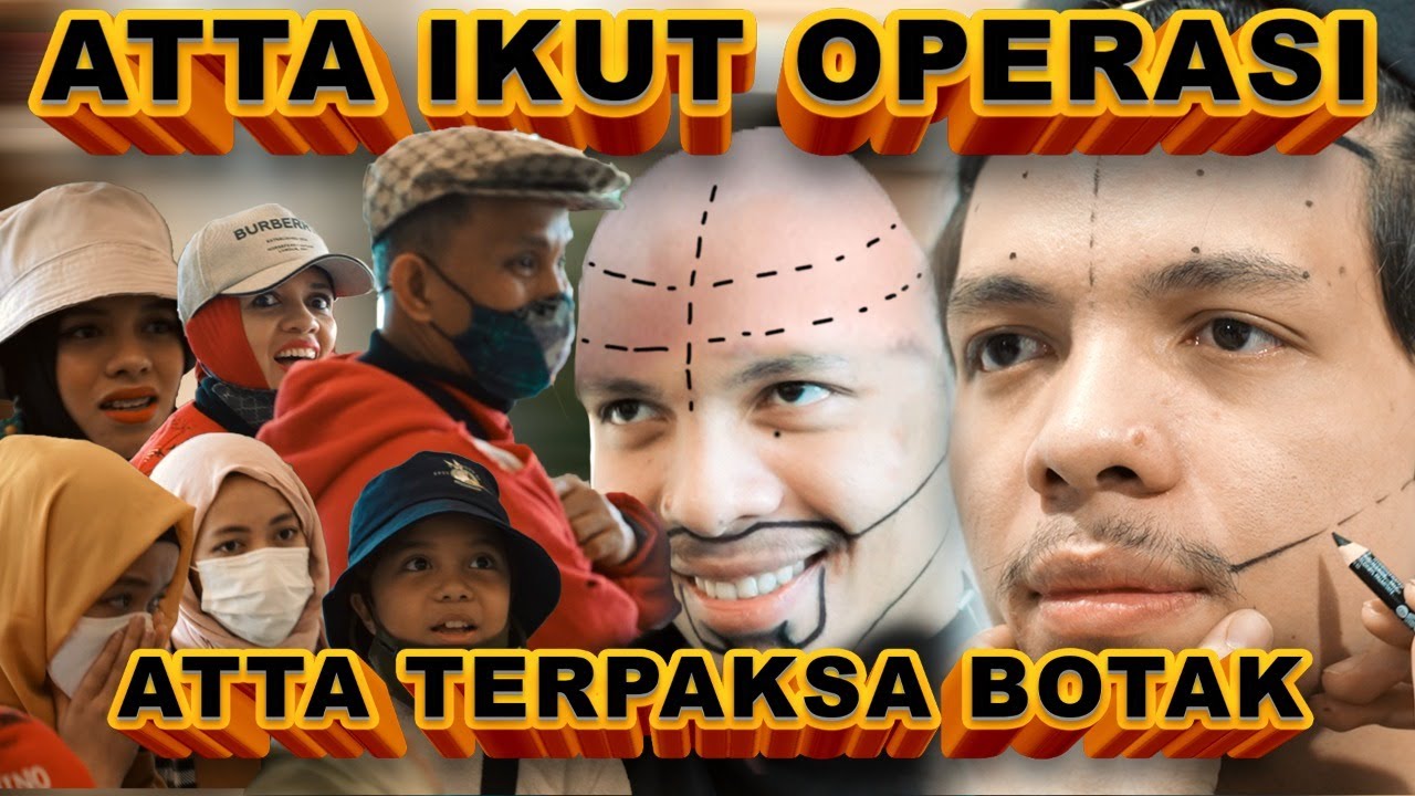 ATTA terpaksa BOTAK. Karna Operasi juga