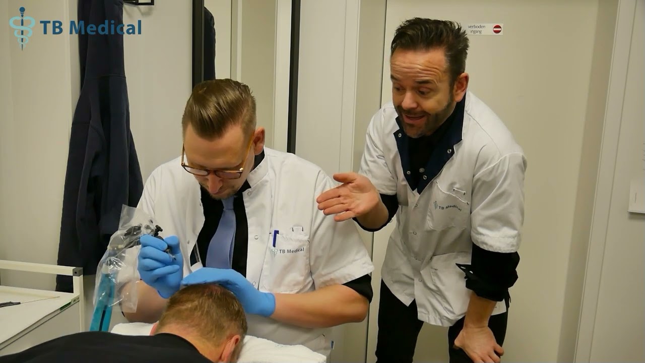 Kale kruin opvullen met mhp micro haar pigmentatie ofwel stoppeltattoo