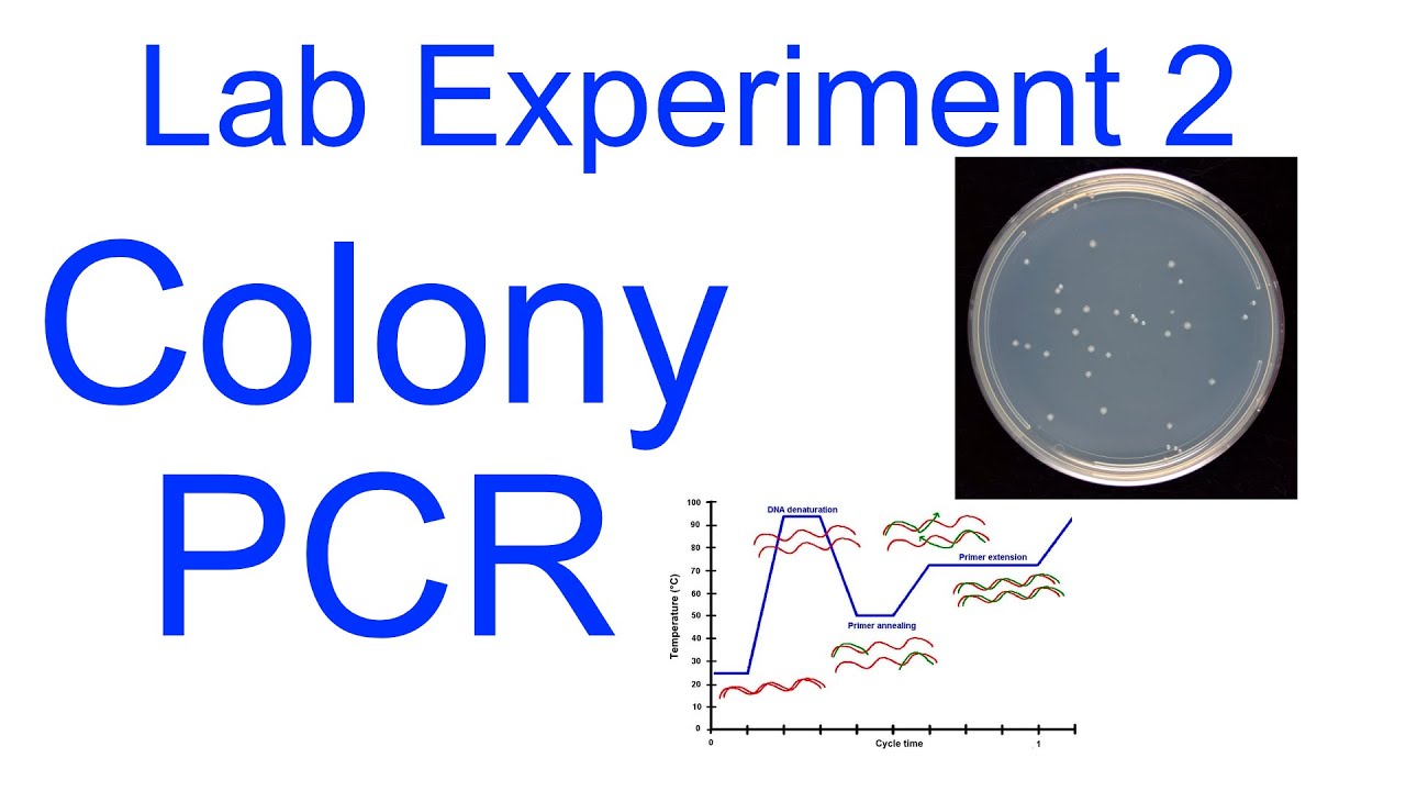 E. coli Colony PCR