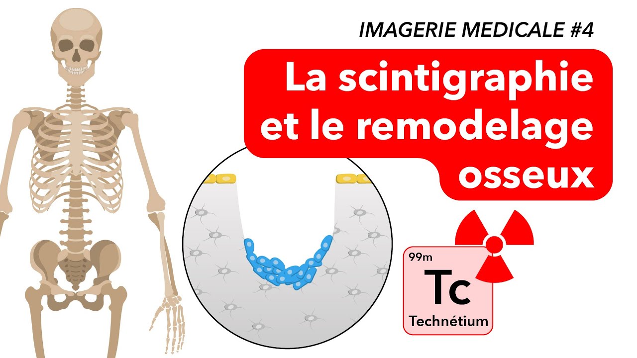 IMAGERIE MEDICALE #4 : La scintigraphie et le remodelage osseux