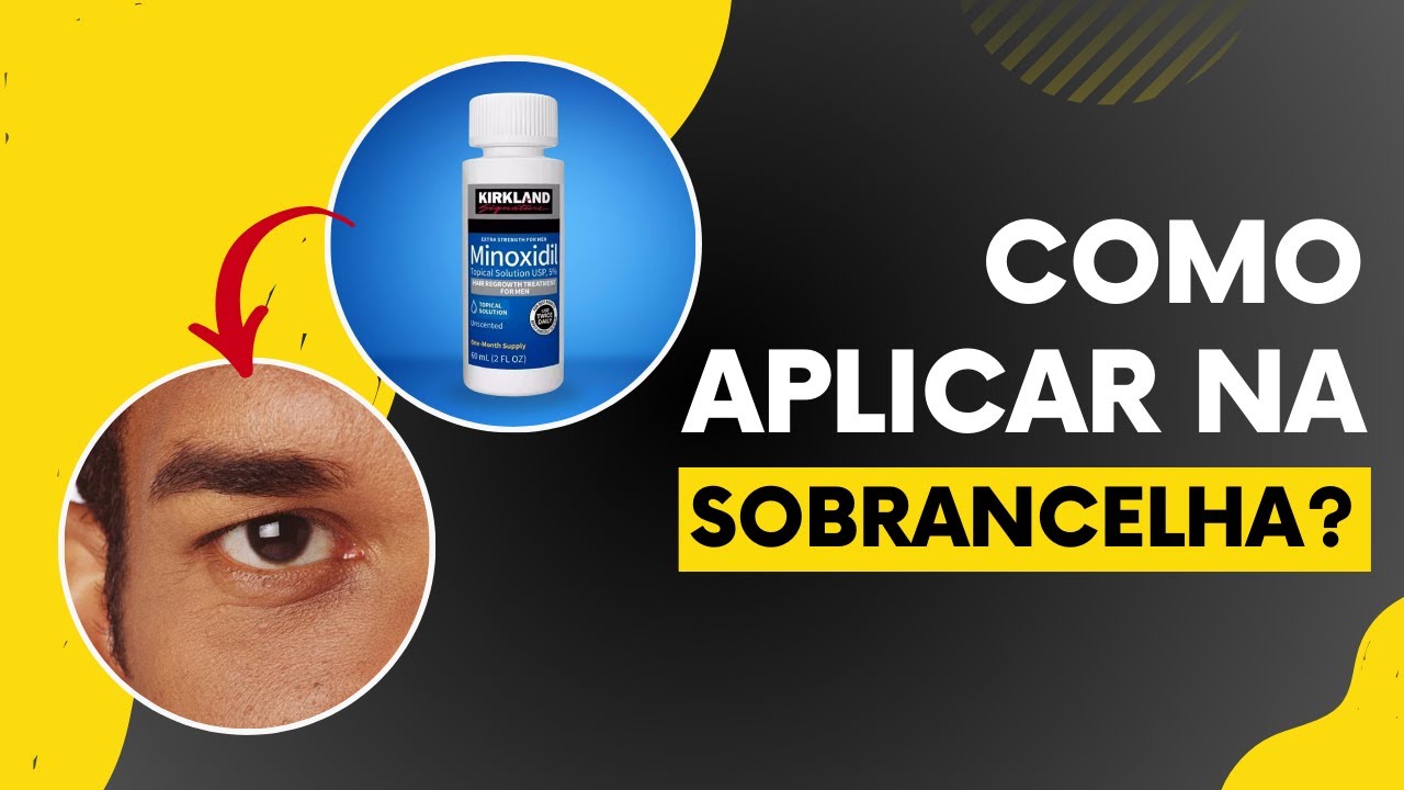 Como Fazer Sobrancelhas Crescerem Mais Rápido com Minoxidil!