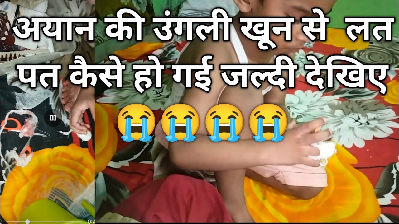 अयान की उंगली खून से कैसे लत पत हो गई जल्दी देखिए😭😭😭