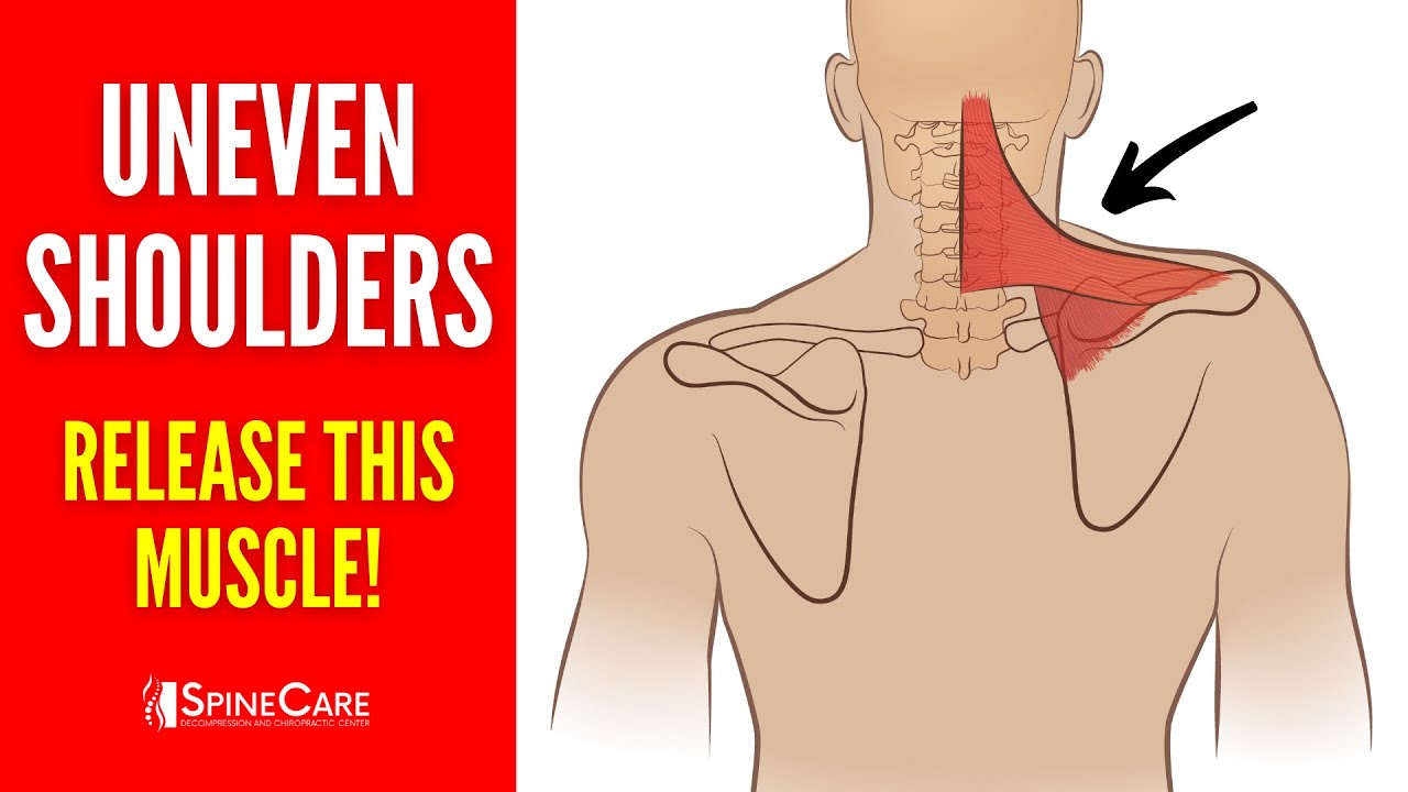 #1 Muscle to Release to Fix Your Uneven Shoulders