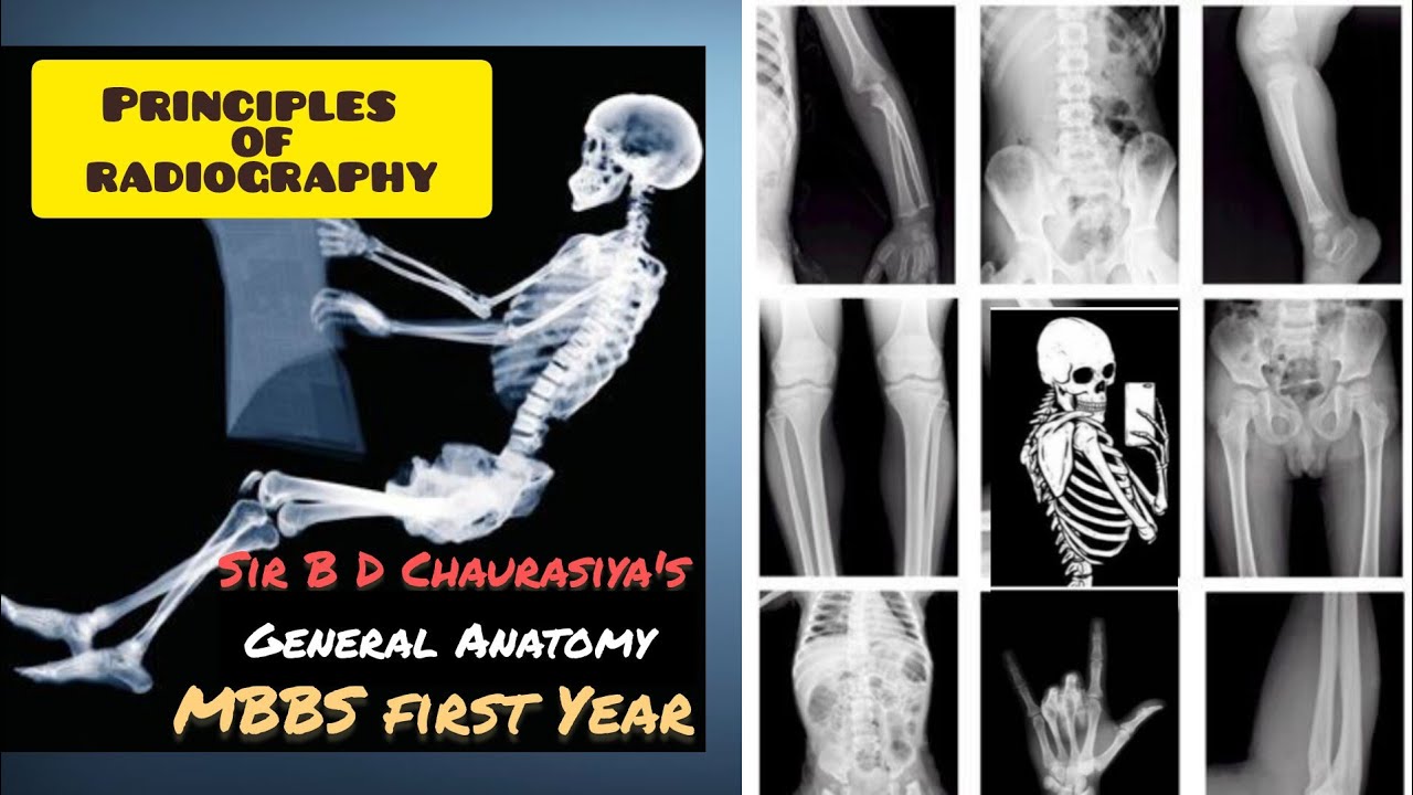 Principles of RADIOGRAPHY 💯  General Anatomy handbook || Complete chapter #radiology #radiography