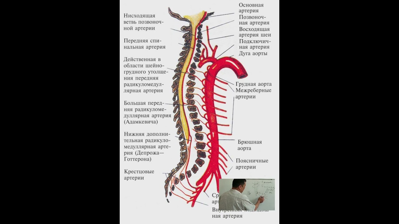 диск чуррасини оекда  фалажлик(парез)га сабаб буладиган тури ( орка мия ва нерв томирлари ишемияси )