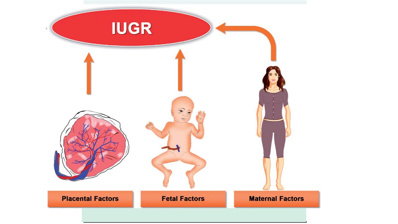 Prematurity & Low Birth Weight