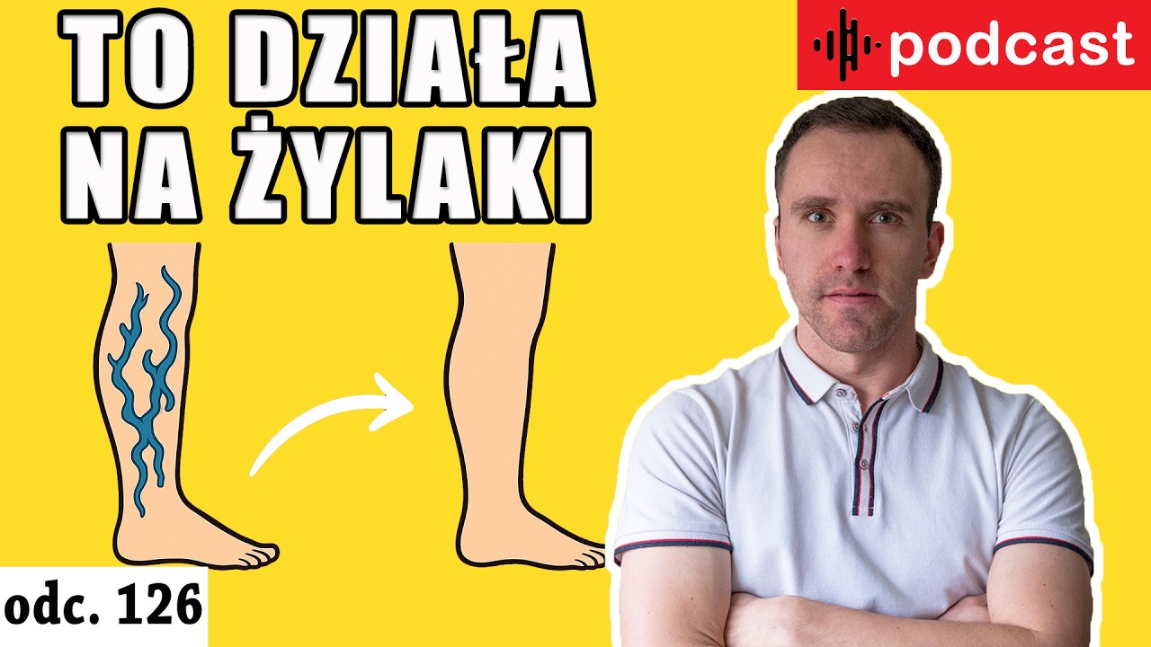 Żylaki i hemoroidy. Co naprawdę działa? | Podcast 2026