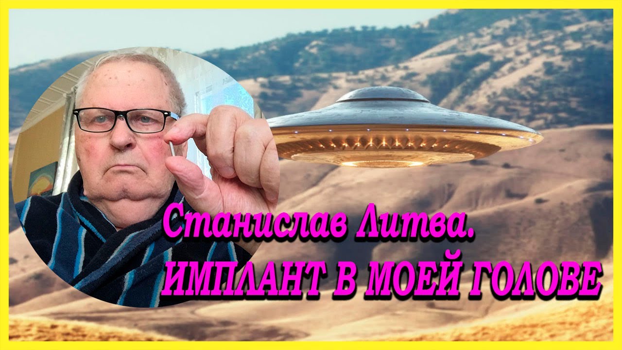 Станислав Литва. Импланты в теле Станислава.
