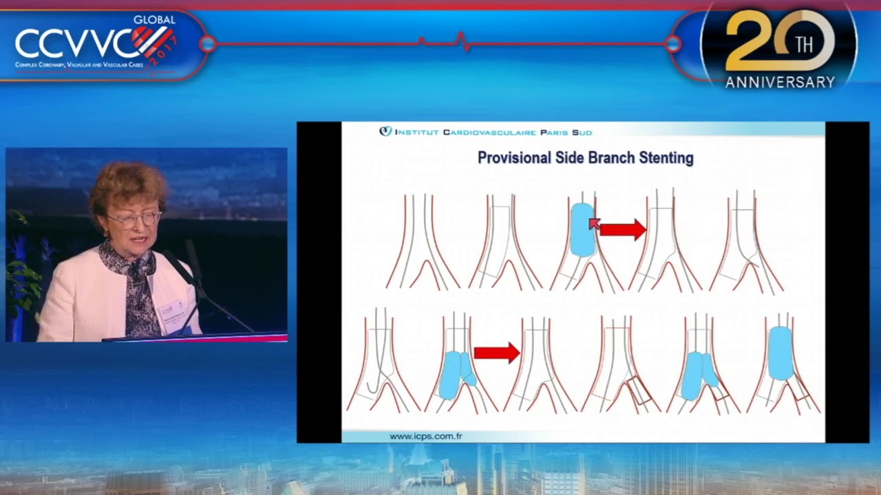 Update in Left Main Bifurcation Lesion Intervention