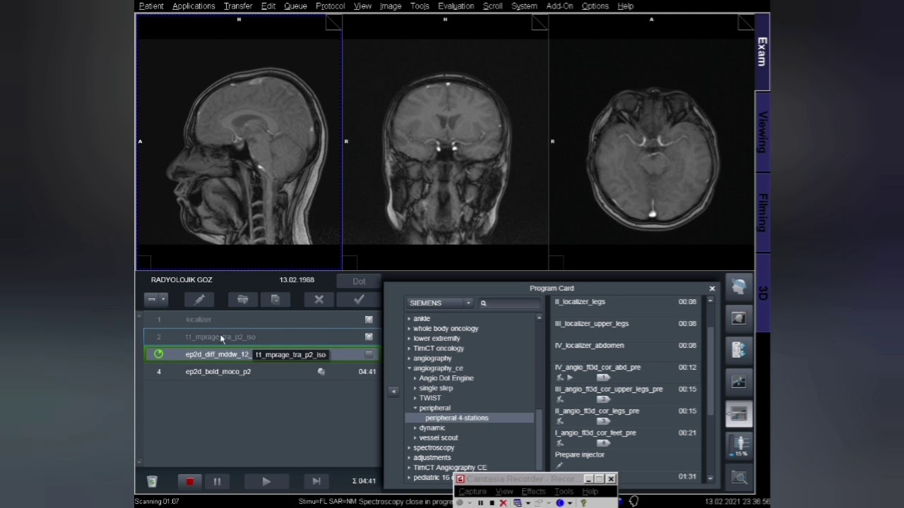 TRACTOGRAPHY EMAR (MR) VE FONKSİYONEL EMAR(MR) ÇEKİMİ
