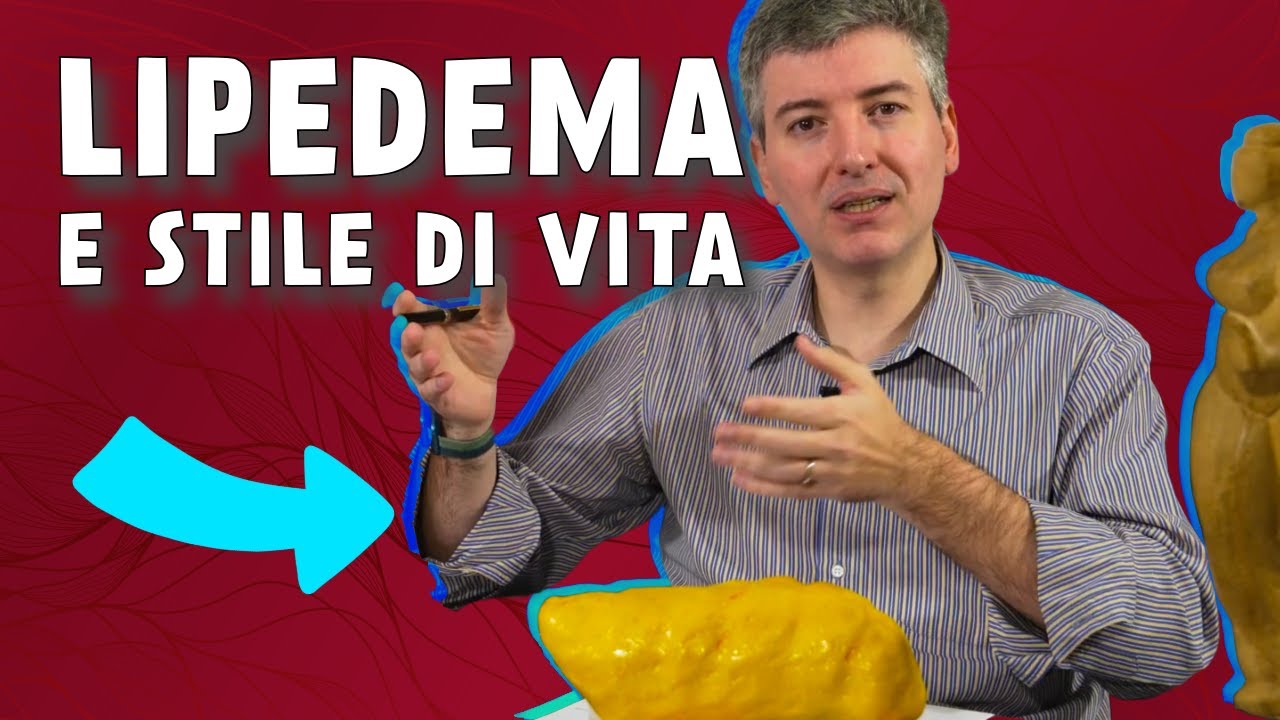 Stile di Vita e Lipedema: Nutrizione, Esercizio e Molto Altro