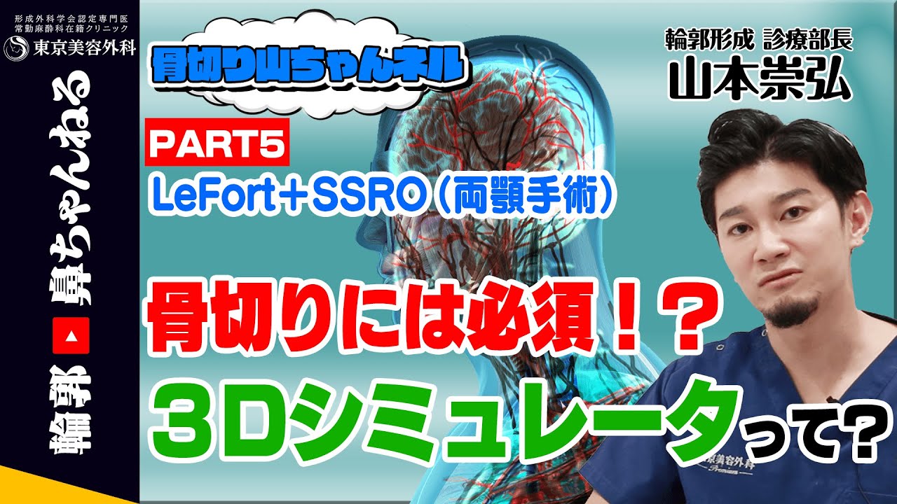 【骨切り山ちゃんネル】Lefort＋SSRO（両顎手術）で絶対使用する！？3Dシミュレーターってなに？　PART5
