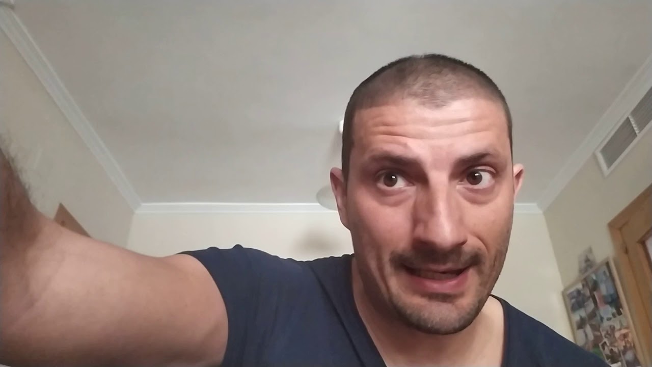 Calvicie desaparece en 1 min, Combinando cubritint con este producto.