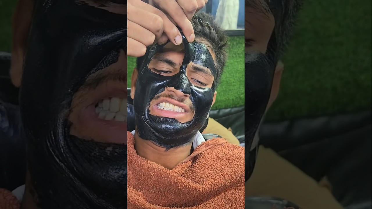 How to Remove Blackheads Fast | Best Blackhead Remover Mask Tutorial