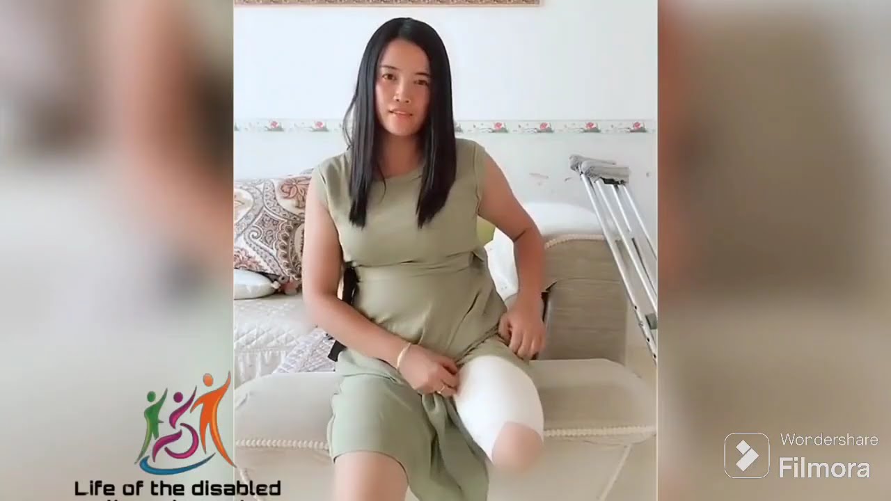 The beautiful amputee woman challenges the disability with one leg 