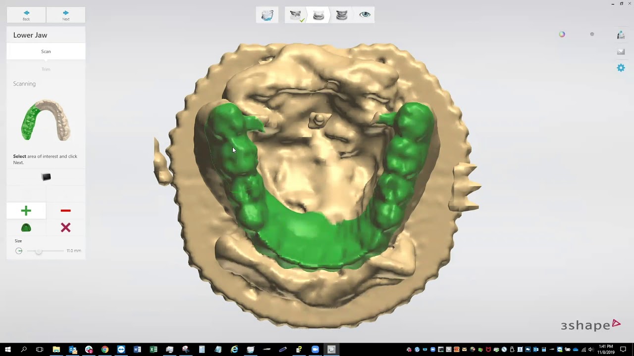 Getting Started With 3Shape Copy Denture