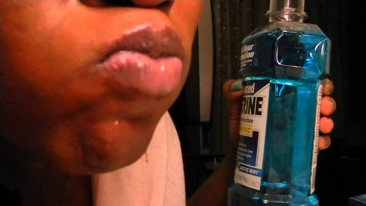 {#27}: (mouthwash rinse) : BRUSHING TEETH WITH BRACES ON (part#4)
