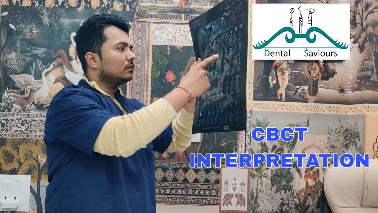 CBCT Interpretation for Dental Implants | Read Before You Drill | Episode 5