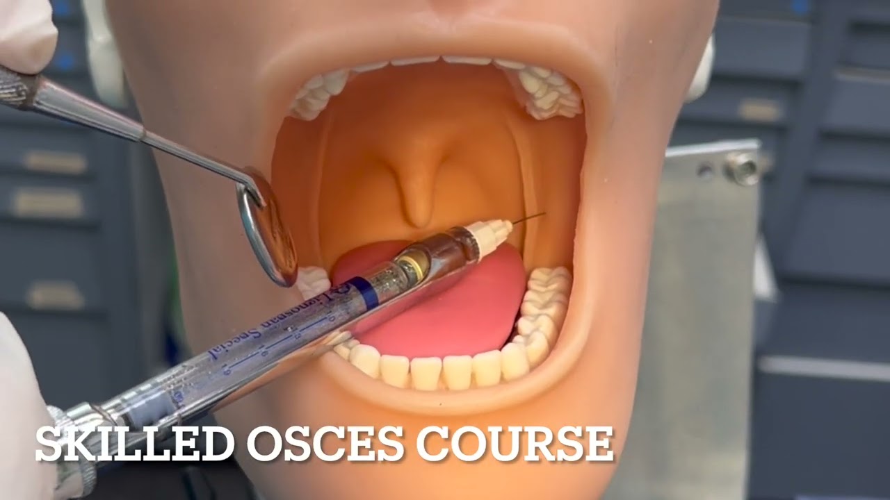 inferior alveolar nerve block technique by Sarah Hussein