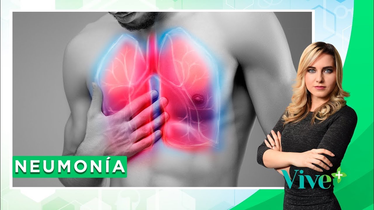 Neumonía: Síntomas, diagnóstico y tratamiento | Vive Más - #ConsultorioEnLínea