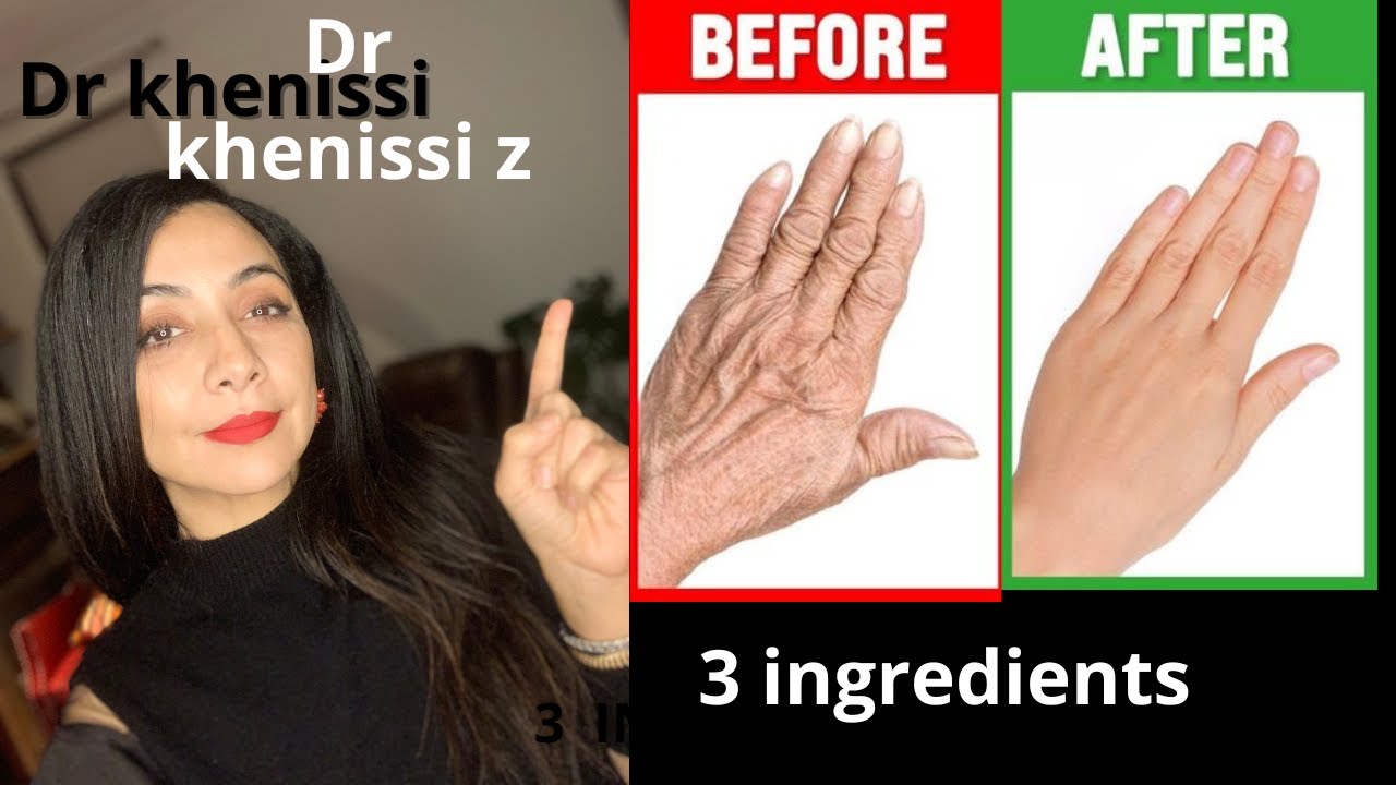 Revitalize Your Hands: Effective Tips for Restoring Soft, Smooth Skin