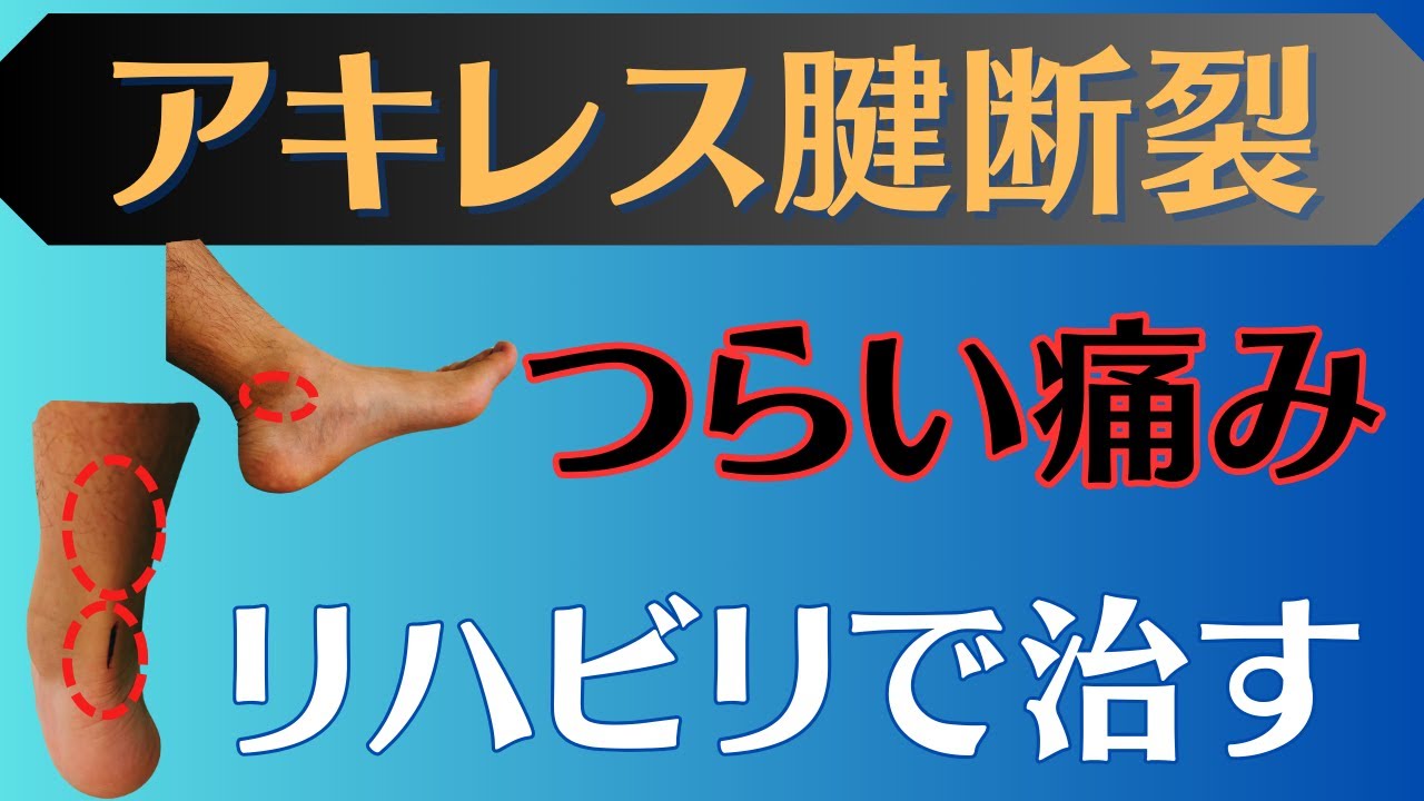 【痛い方】アキレス腱断裂　痛みが出やすい部分と改善方法