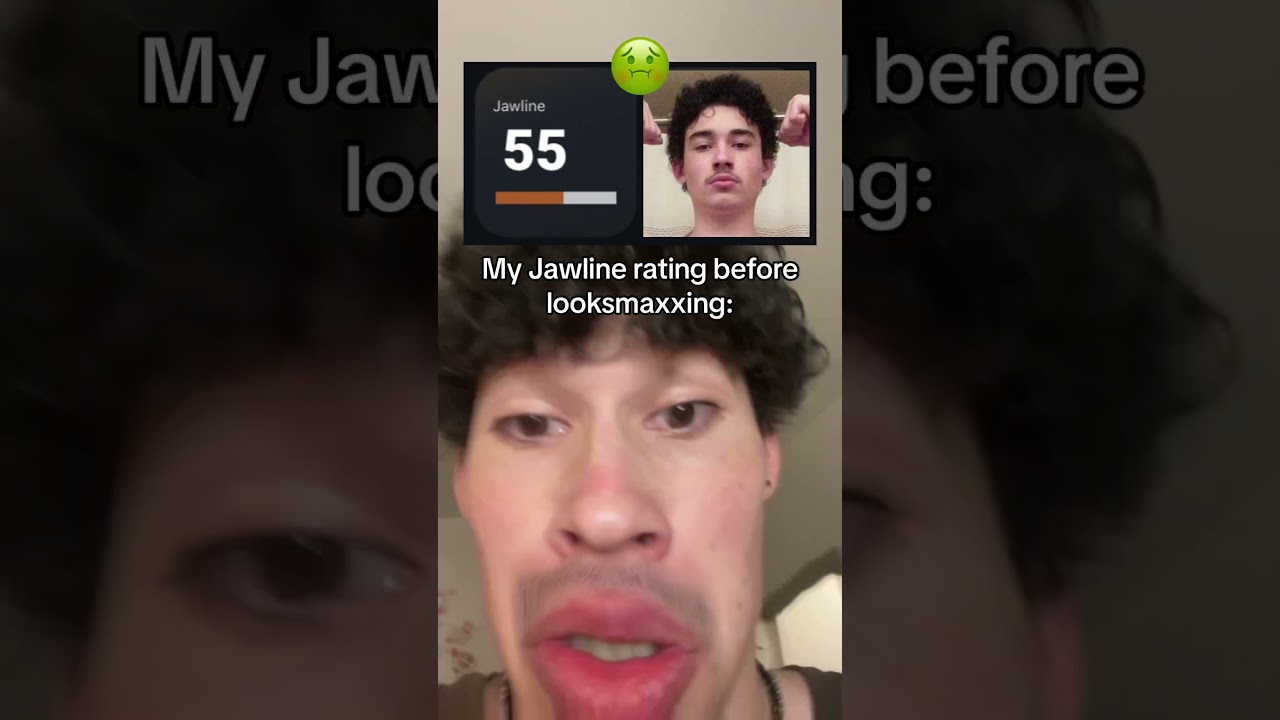 MY INSANE 2 YEAR JAWLINE TRANSFORMATION  
