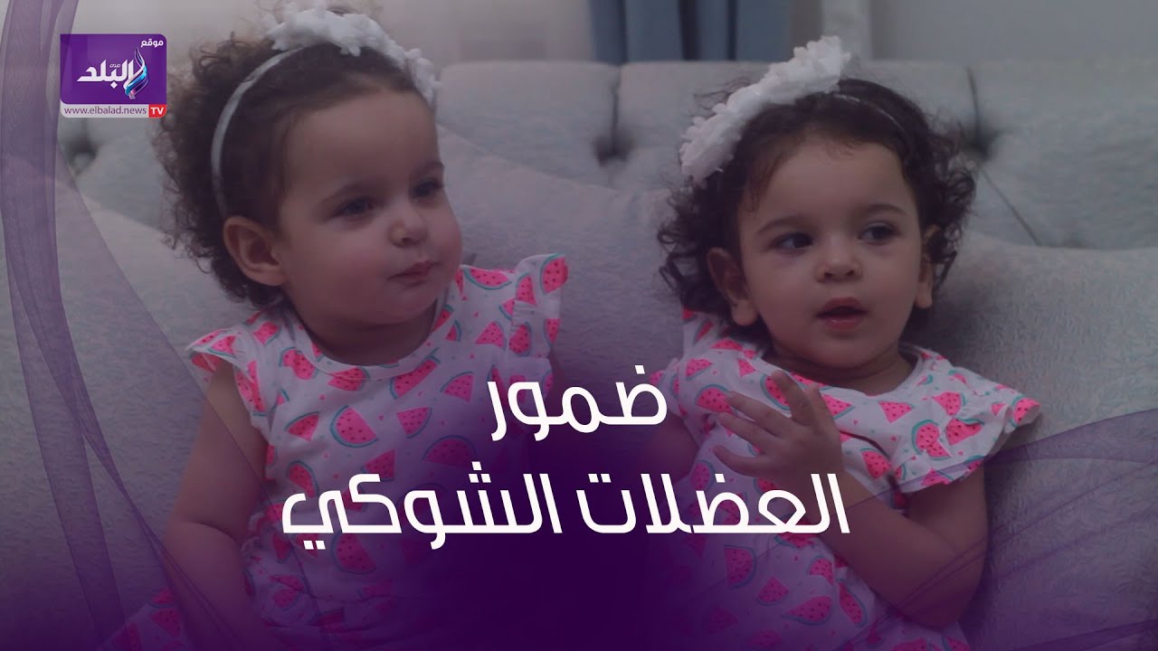 استغاثة عاجلة .. أم تناشد الرئيس لإنقاذ طفلتيها من ضمور العضلات الشوكي