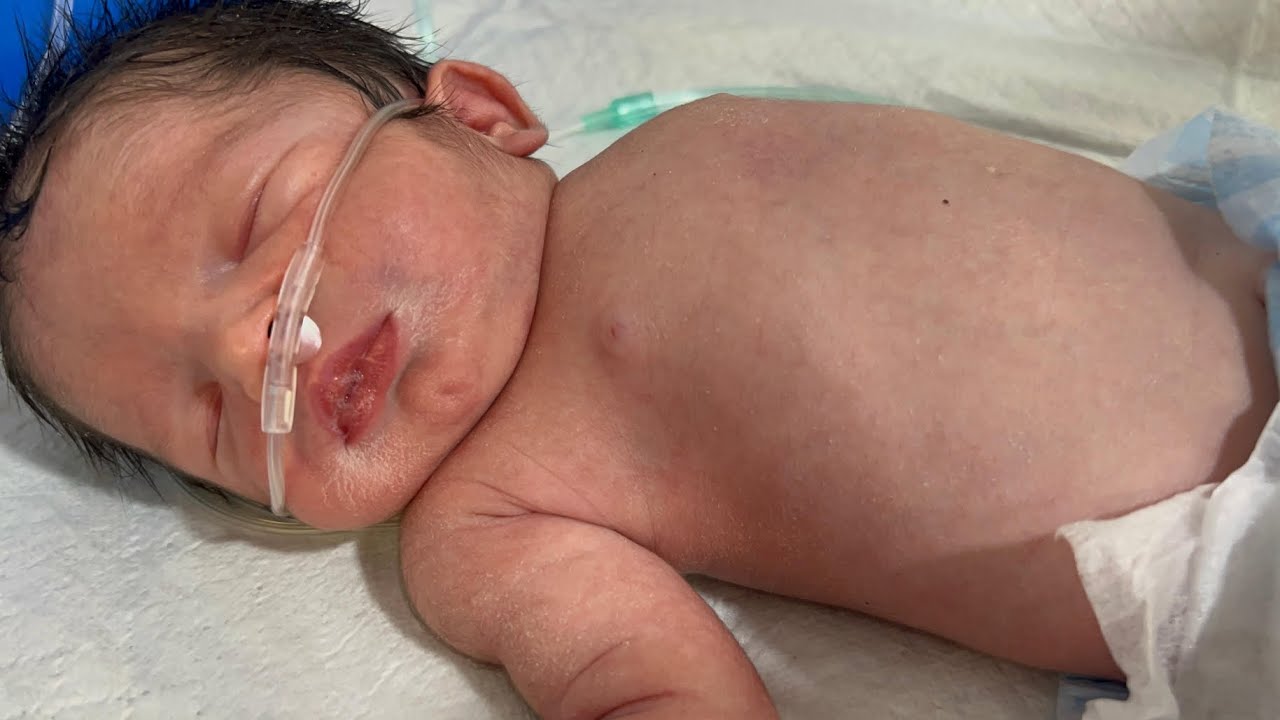 Newborn Baby Grunting – Watch This Important Sign 👶💔